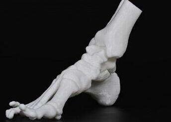 医疗3D打印：用科技与医疗碰撞出智慧的火花