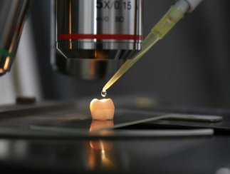 我国科学家在基于磷酸钙纳米簇修复牙釉质方面取得突破