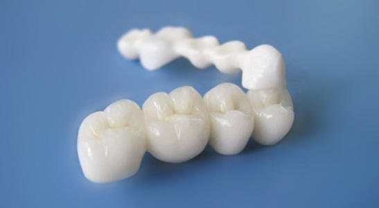 像真牙一样的假牙 新型材料义齿有望替代烤瓷牙