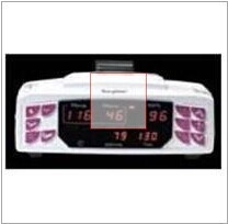 无创血压监测仪Non-Invasive Blood Pressure Monitors的图片