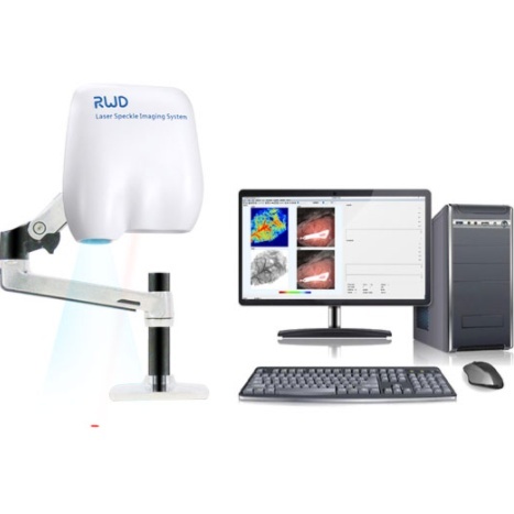 RFLSIⅢ激光散斑血流成像系统激光多普勒血流仪的图片
