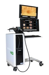 皮肤镜图像分析系统的图片