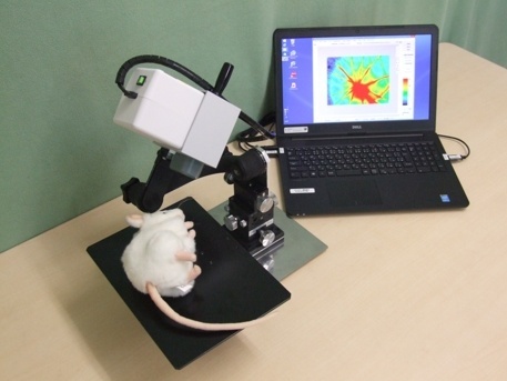 眼睛眼底视网膜学流成像系统的图片