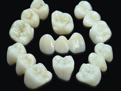 二氧化锆全瓷牙究竟好在哪？