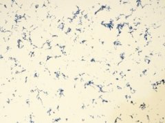 花纹石英石2的图片