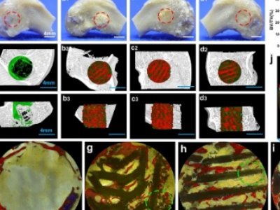 上海硅酸盐所在生物陶瓷领域再获重要进展