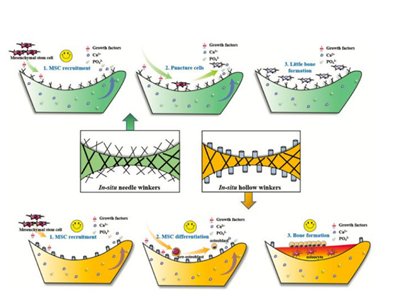 四川大学张兴栋院士团队在磷酸钙生物陶瓷领域取得进展