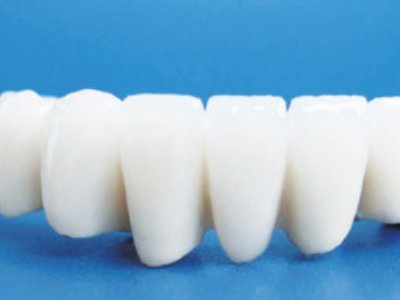 氧化铝生物陶瓷、ZTA等182项拟立项推荐性国家标准项目公开征求意见