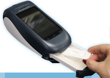 QuickChekTM SRB检测系统的图片