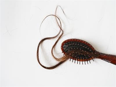 押宝脱发，开拓药业能否实现业绩翻身？