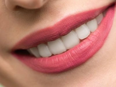 【生活中的粉体】金属烤瓷牙与氧化锆全瓷牙对比