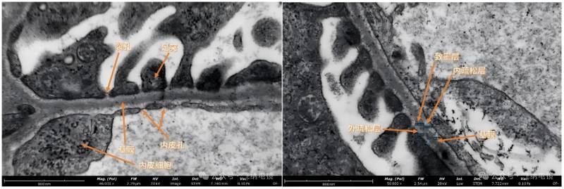 台式扫描透射电镜下小鼠肾组织