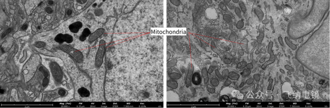 左：染色；右：未染色